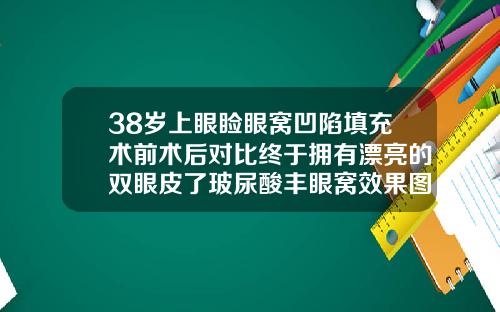 38岁上眼睑眼窝凹陷填充术前术后对比终于拥有漂亮的双眼皮了玻尿酸丰眼窝效果图片