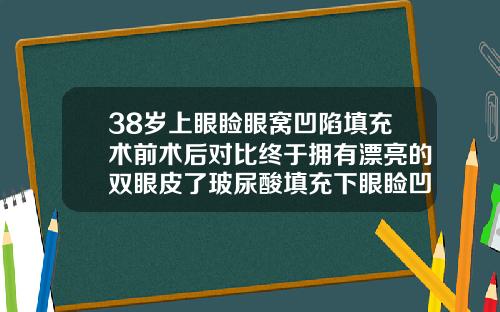 38岁上眼睑眼窝凹陷填充术前术后对比终于拥有漂亮的双眼皮了玻尿酸填充下眼睑凹陷会影响眼球吗
