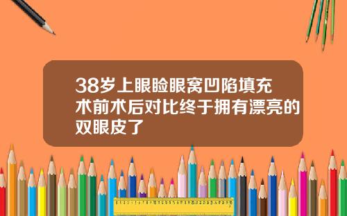 38岁上眼睑眼窝凹陷填充术前术后对比终于拥有漂亮的双眼皮了