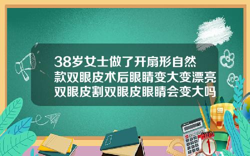 38岁女士做了开扇形自然款双眼皮术后眼睛变大变漂亮双眼皮割双眼皮眼睛会变大吗