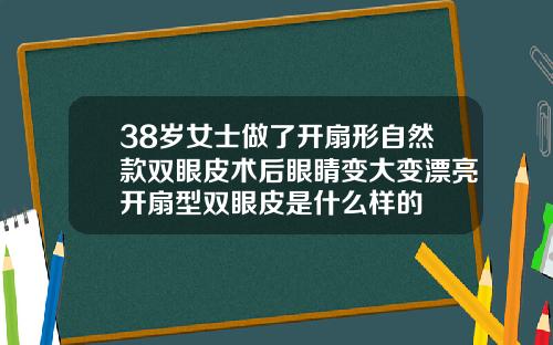 38岁女士做了开扇形自然款双眼皮术后眼睛变大变漂亮开扇型双眼皮是什么样的