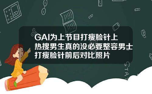 GAI为上节目打瘦脸针上热搜男生真的没必要整容男士打瘦脸针前后对比照片