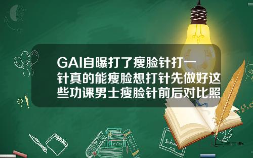 GAI自曝打了瘦脸针打一针真的能瘦脸想打针先做好这些功课男士瘦脸针前后对比照片实拍