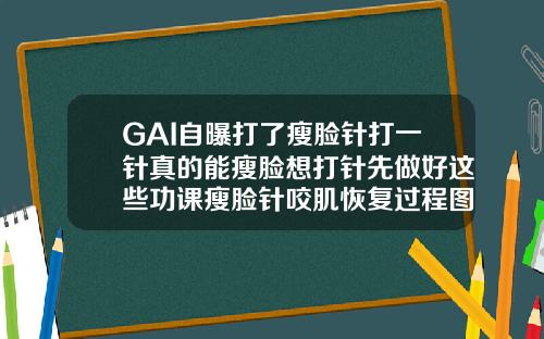 GAI自曝打了瘦脸针打一针真的能瘦脸想打针先做好这些功课瘦脸针咬肌恢复过程图