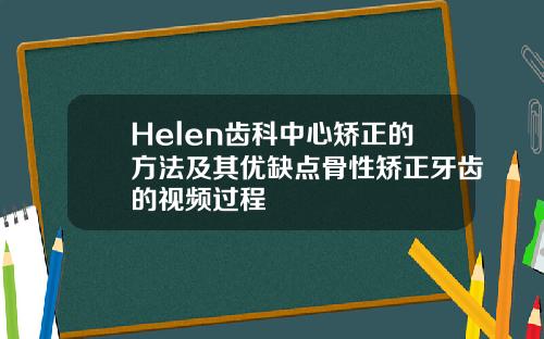 Helen齿科中心矫正的方法及其优缺点骨性矫正牙齿的视频过程