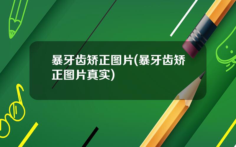 暴牙齿矫正图片(暴牙齿矫正图片真实)