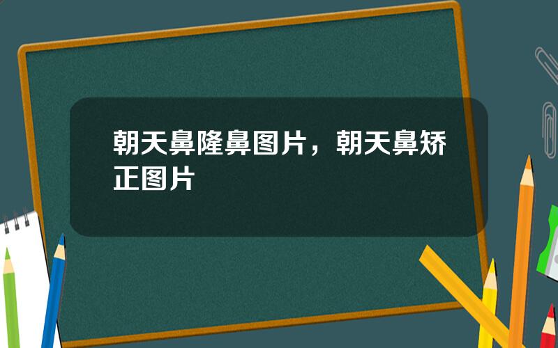 朝天鼻隆鼻图片，朝天鼻矫正图片