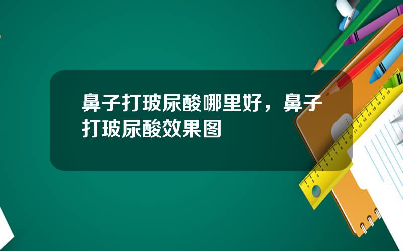 鼻子打玻尿酸哪里好，鼻子打玻尿酸效果图